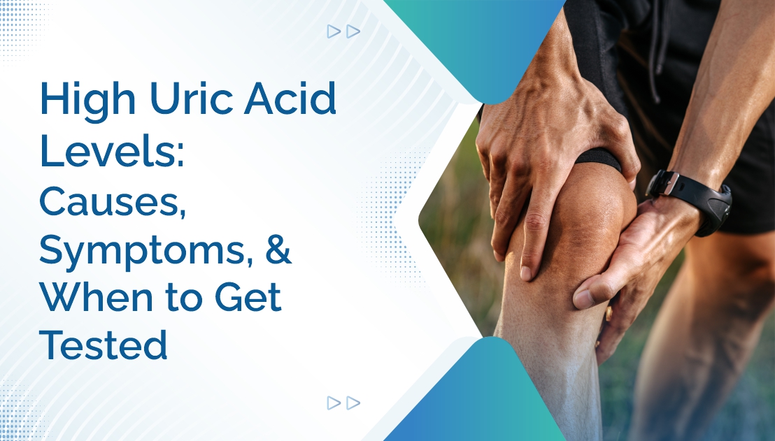 High Uric Acid Levels: Causes, Symptoms, and When to Get Tested